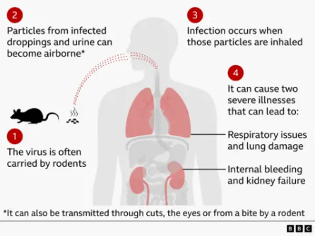 Mice, Myths, and Medicine: The Hantavirus